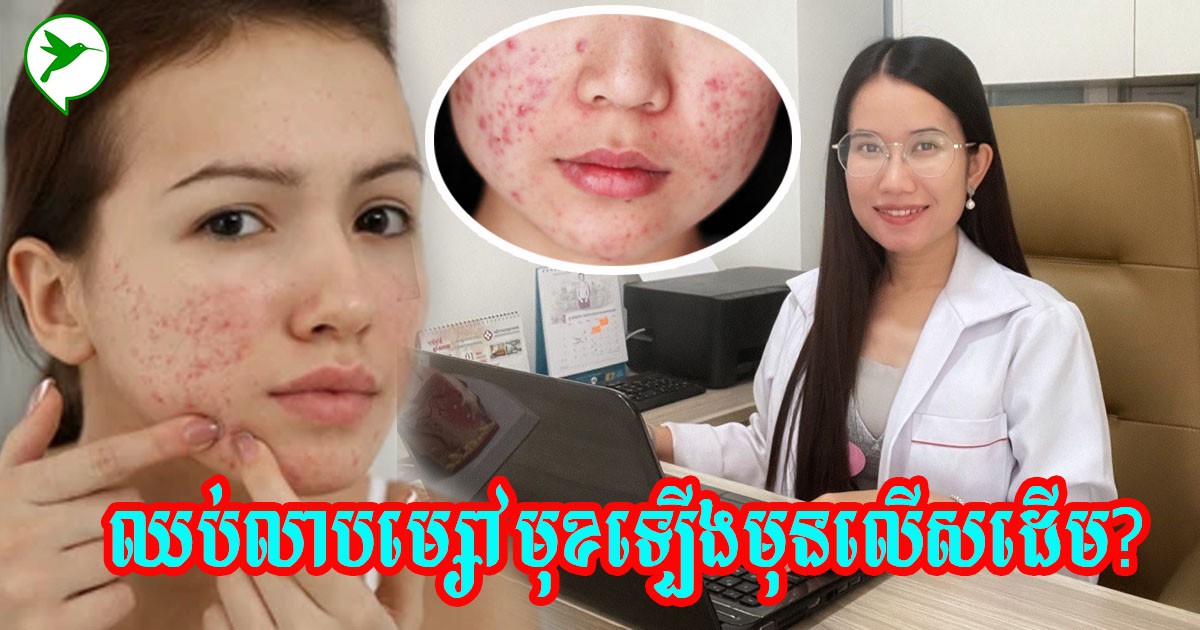 ធ្លាប់ឆ្ងល់ខ្លះទេ? ហេតុអ្វីឈប់លាបម្សៅ ផ្ទៃមុខជួបបញ្ហាមុន ជាំ ហើយអាក្រក់លើសដើម?