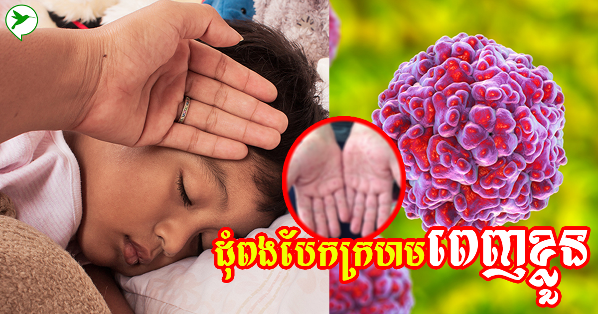 ប្រយ័ត្ន! បើកូនអ្នកចេញពងបែកក្រហមៗ និងសញ្ញាទាំងនេះលើស ៣ថ្ងៃ ប្រញាប់នាំកូនទៅពេទ្យភ្លាម