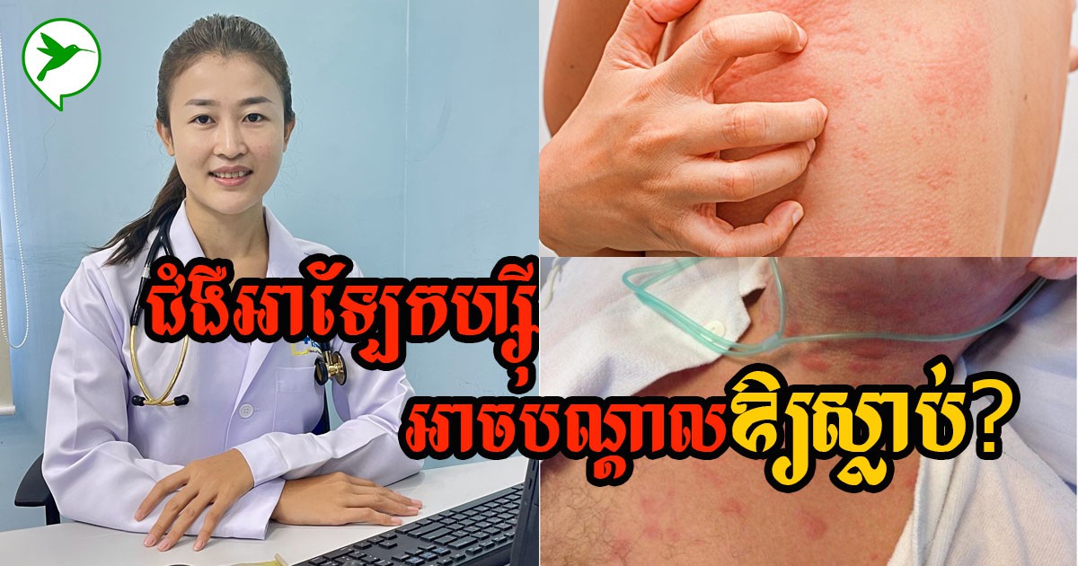 វេជ្ជបណ្ឌិត ហាន ដានី៖ តើជំងឺអាឡែកហ្ស៊ីអាចគ្រោះថ្នាក់ដល់អាយុជីវិតដែរឬទេ?