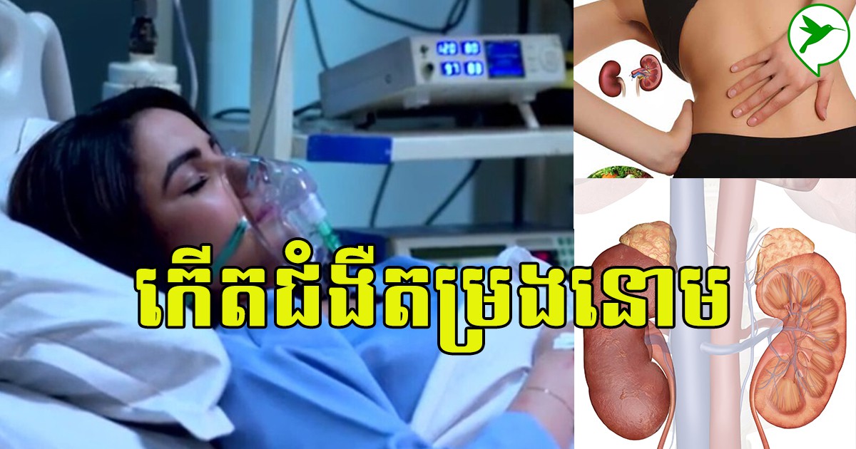 ក្រៅពីជំងឺលើសសម្ពាធឈាម និងទឹកនោមផ្អែម ជំងឺLupus ក៏នាំឲ្យកើតជំងឺខ្សោយតម្រងនោមដែរ
