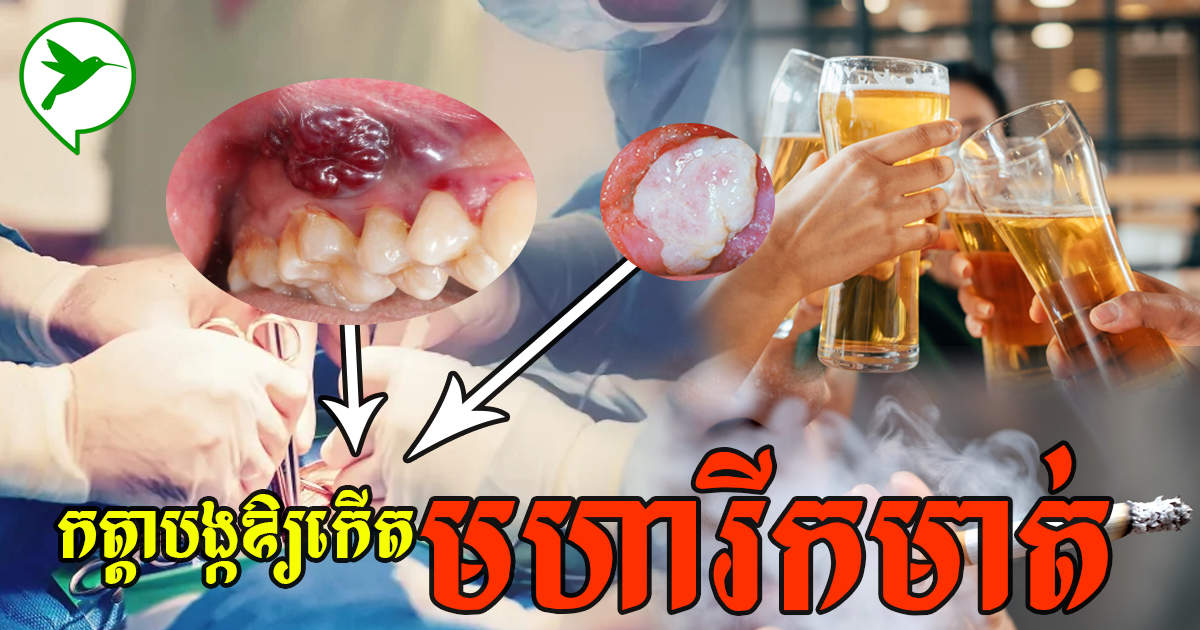 អ្នកងាយនឹងកើតជំងឺមហារីកមាត់ បើអ្នកមិនកាត់បន្ថយការប្រើប្រាស់របស់ទាំង៣នេះទេ