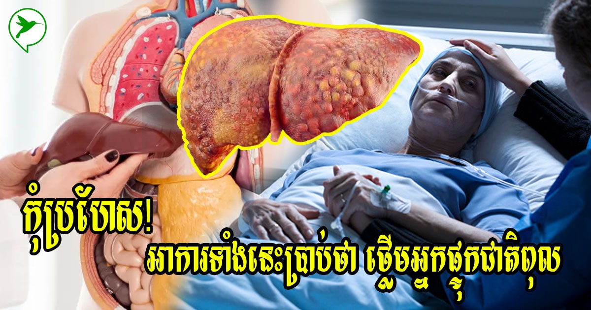 កុំបណ្ដោយខ្លួនឱ្យសោះ! អាការទាំងនេះបង្ហាញថា ថ្លើមរបស់អ្នកកំពុងមានជាតិពុល