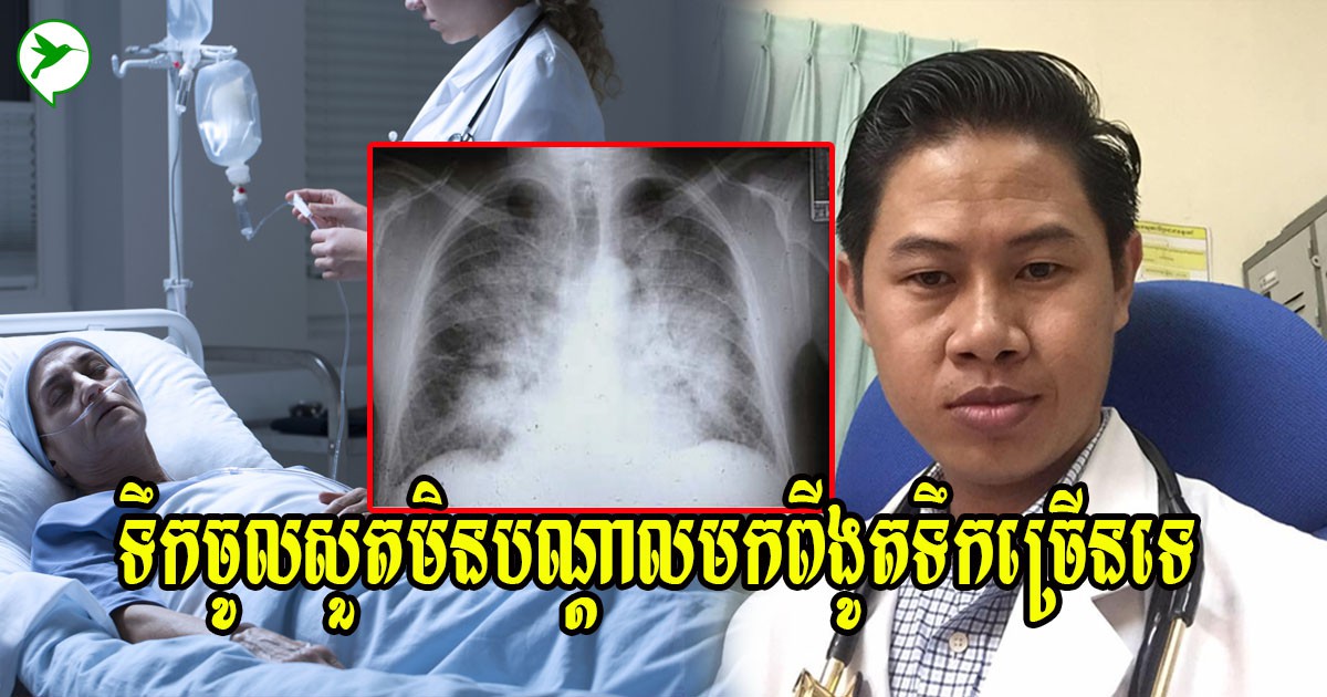 វេជ្ជ. ប្រាប់ពីមូលហេតុទឹកចូលសួតដែលប្រជាជនខ្មែរតែងយល់ច្រលំ និងវិធីសង្គ្រោះបឋមនៃជំងឺនេះ